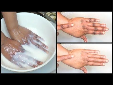 Dark Hands Remedies, Younger Looking Hands, Khichi Beauty, Softer Hands, Dark Spots On Legs, Skin Lightening Diy, Dark Hands, Dark Knuckles, Dark Spots Remedies