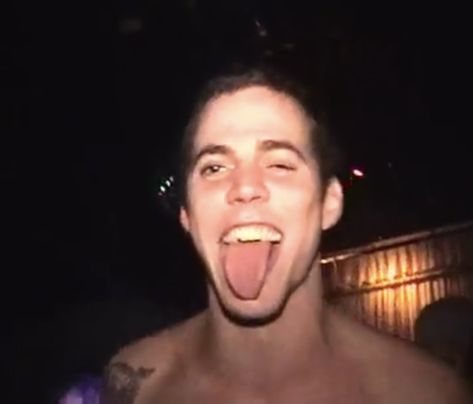 Steve O 2000s, Steve O Wallpaper, Johnny Knoxville And Steve O, Steve O Young, Steve O Aesthetic, Johnny Knoxville, Broken Ribs, Bam Margera, Steve O