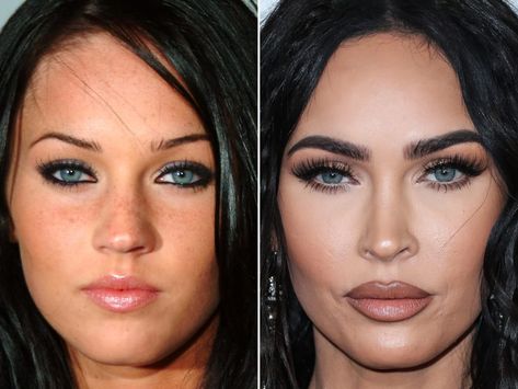 Megan Fox Lips, Fox Eye Makeup, Megan Fox Face, Cheek Implants, Fox Makeup, Lip Types, Botox Lips, Instagram Vs Real Life, Fox Eyes