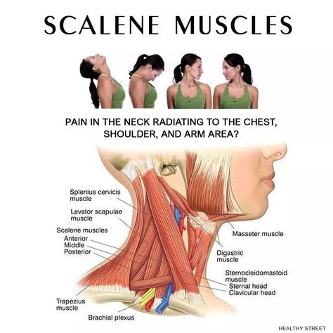 Scalene Muscle, Neck Posture, Sternocleidomastoid Muscle, Shoulder Pain Exercises, Pregnancy Massage, Neck Exercises, Posture Exercises, Muscle Anatomy, Neck And Shoulder Pain