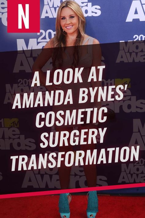 We haven't seen much of Amanda Bynes in the last decade, so when she does appear on social media, or the media in general, there's a lot of buzz. #amandabynes #celebrities #transformations Amanda Bynes Now, Celebrity Plastic Surgery, Amanda Bynes, Easy A, Admit It, The Kardashians, Famous Celebrities, Most Expensive, Plastic Surgery