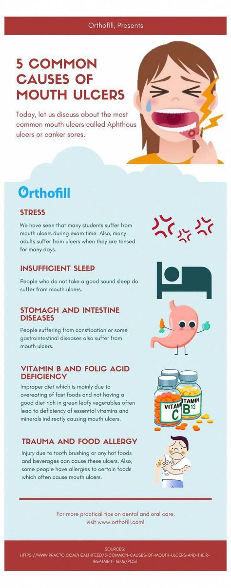 #oral #care #mouthwash #pocket #disc 5 Common Causes of Mouth Ulcers. Dental Infographics to make you more aware of dental and oral problems. Visit www.Orthofill.com to learn more! #HowToCareForOralSurgery #HowImportantIsOralCare #WhatIsOralHealthCare #OralDentalCare #WhatIsMoonOralCare #PreventiveOralHealthCare Dental Infographics, Tooth Caries, Abscess Tooth, How To Remove Warts, Remove Warts, Medicine Tips, Gastrointestinal Disease, Bad Teeth, Pediatric Dentist