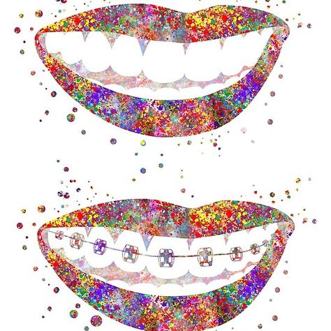 Dental Illustration Art, Dental Backgrounds, Dental Tableau, Cartoon Dental Art, Orthodontic Posters, Dentist Art Design Teeth, Invisible Teeth Braces, Natural Teeth Whitening Diy, Dental Wall Art