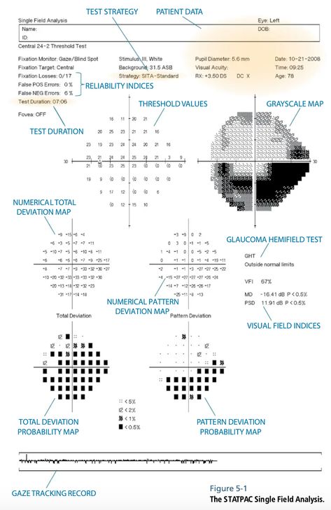 Optometry Notes, Optometry School Notes, Optometrist Aesthetic, Optometry Aesthetic, Optometry Assistant, Opthamology Notes, Optometric Technician, Opthalmic Technician, Ophthalmology Poster