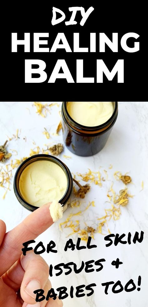 This is our favorite skin healing balm! It started out as a baby balm and then we started using it for everything! This skin healing balm is great for any type of skin irritation, bug bites, dry skin, keratosis pilaris and of course it's a great diy diaper cream! #skincare #greenbeauty Ketosis Pilaris, Healing Balm Recipe, Diy Healing Balm, Homemade Salve, Healing Salve, Cream Skincare, Baby Balm, Salve Recipes, Type Of Skin