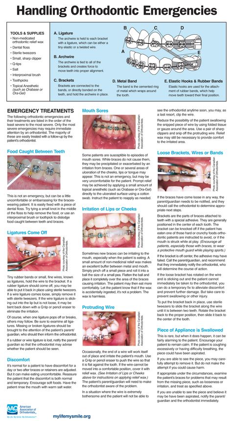 Orthodontist Assistant, Dental Infographics, Orthodontics Marketing, Braces Care, Braces Food, Happy Dental, Future Dentist, Dental Assistant Study, Dental Assisting