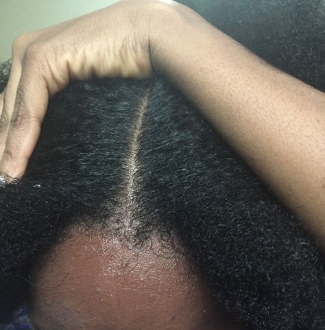 A clean scalp is the first step to healthy hair #washday #4b #4c #curlkink #blackgirl 4c Healthy Hair, Retaining Length 4c Hair, Healthy Scalp Aesthetic, Clear Skin And Healthy Hair Vision Board, Healthy 4c Hair Aesthetic, Wash Day Aesthetic, 4c Hair Aesthetic, Healthy 4c Hair, Healthy Hair Aesthetic