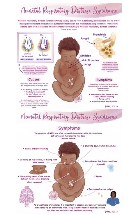 Neonatal Respiratory Distress Syndrome, Labor And Delivery Nursing School Notes, Nicu Nurse Tips, Neonatal Nurse Aesthetic Notes, Nicu Nursing Notes, Respiratory Distress Syndrome Newborn, Nicu Nurse Study Notes, Nicu Nurse Notes, Nicu Nursing Education