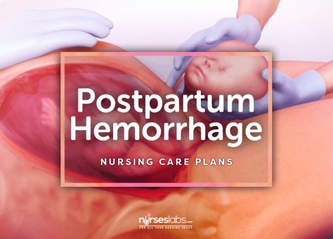 8 Postpartum Hemorrhage Nursing Care Plans Post Partum Hemorrhage, Bsc Nursing, Postpartum Hemorrhage, Student Midwife, Nursing Diagnosis, Nursing Care Plan, Neonatal Nurse, Neonatal Intensive Care Unit, Nursing Career