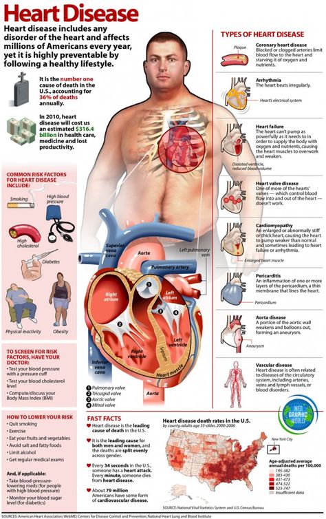 Some facts on heart disease to help keep you #HeartHealthy Disease Infographic, The Human Heart, Cardiac Nursing, Meals Recipes, Recipes Diet, Heart Conditions, Nursing Tips, Fodmap Diet, Nursing Study