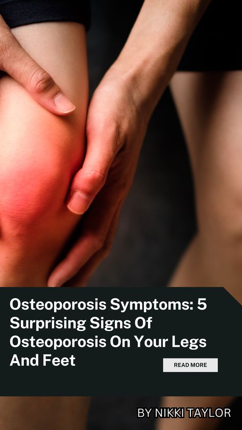 Unveiling Osteoporosis: Unexpected Signs in Your Legs and Feet World Osteoporosis Day, Osteoporosis Symptoms, Osteoporosis Exercises, Cold Prevention, Health Trends, Leg Pain, Heel Pain, Signs And Symptoms, Bone Health