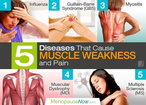 Muscle weakness and pain can be a symptom of a wide number of health matters. Learn about some of the most common diseases known to cause this. Seizures Awareness, Muscle Inflammation, Muscle Diseases, Types Of Muscles, Guillain Barre, Guillain Barre Syndrome, Common Diseases, Natural Hormones, Muscle Weakness