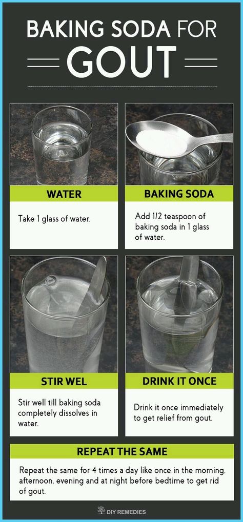 Baking Soda Drink, Healthy Candy, Soda Drink, Glue Remover, Workout Abs, Nutrient Deficiency, Uric Acid, Diy Remedies, Joints Pain Relief