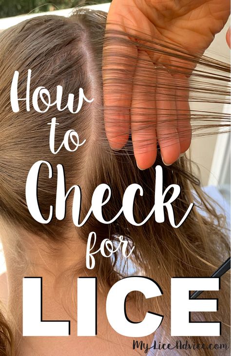 How To Treat Lice, Lice Remedies, Hair Lice, Lice Eggs, Hair Color Guide, Lice Removal, Grey Blonde Hair, Check Yourself, Head Louse