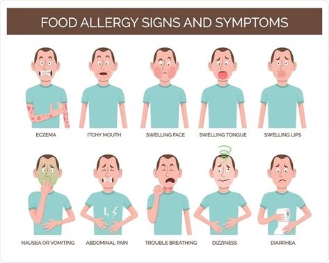 How To Stop Dizziness, Food Allergy Symptoms, Health Care Hospital, Common Food Allergies, Feeling Dizzy, Abdominal Discomfort, Itchy Eyes, Food Allergy, Allergy Symptoms