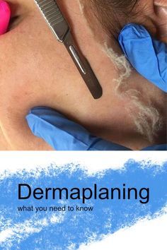 How Often To Dermaplane, Dermaplaning Vs Waxing, Dermaplaning Aesthetic, Peach Fuzz On Face, Derma Planning, Dermaplane Facial, Medical Esthetics, Dermaplaning Facial, Popular Everything