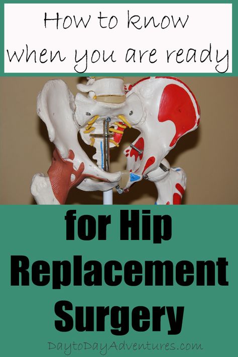 Hip Surgery Recovery, Hip Injury, Knee Health, I Ready, Hip Surgery, Back Stretches For Pain, Strengthen Your Core, Back Hurts, Hip Dysplasia