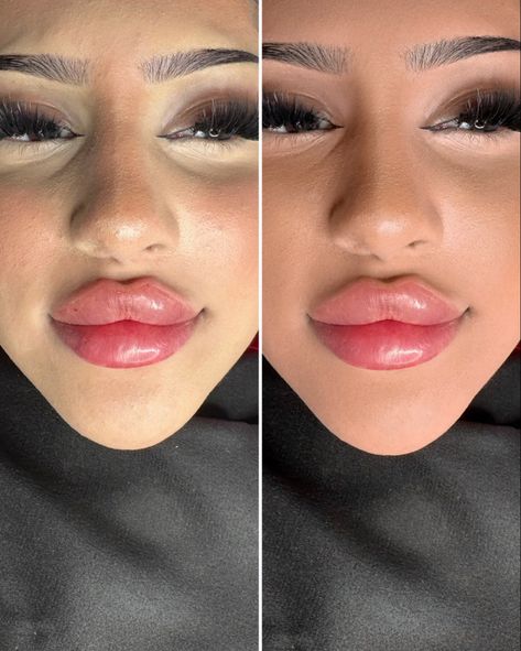 Small Nose Big Lips, Naturally Bigger Lips, Lip Aesthetic, Russian Lips, Lip Flip, Lip Permanent Makeup, Bigger Lips, Big Lips Natural, Lips Shape