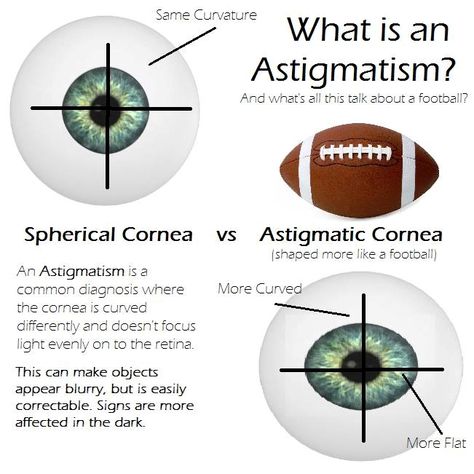 Astigmatism Eye, Opthalmic Technician, Optician Training, Optometry Education, Optician Marketing, Eye Facts, Eye Anatomy, Read Letters, Vision Eye