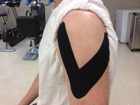 Learn how to apply kinesiology tape (KT tape) for your rotator cuff and shoulder to improve arm function of after injury. Shoulder Rehab Exercises, Rotator Cuff Exercises, Rotator Cuff Surgery, Shoulder Pain Exercises, K Tape, Shoulder Rehab, Rotator Cuff Tear, Shoulder Impingement, Rotator Cuff Injury