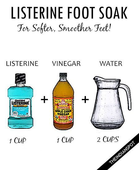 Listerine Foot Soak, Listerine Mouthwash, Diy Pedicure, Meaningful Beauty, Foot Soak, Top Skin Care Products, Beauty Remedies, Homemade Remedies, Healthy Skin Care