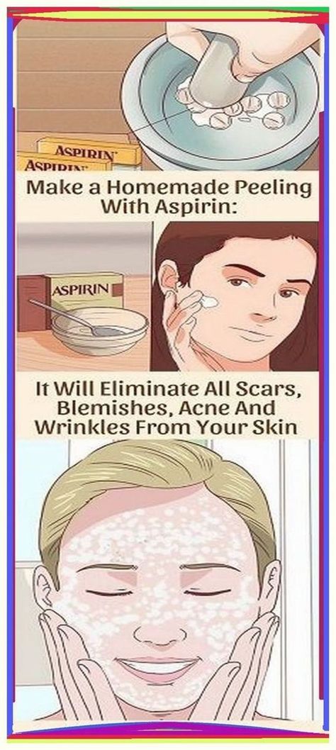 I have so much gratitude for you. Brilliant information! Aspirin Face Mask, Aspirin Mask, How To Remove Pimples, Homemade Face Masks, Homemade Face, Skin Complexion, Skin Issues, How To Treat Acne, Healthy Tips