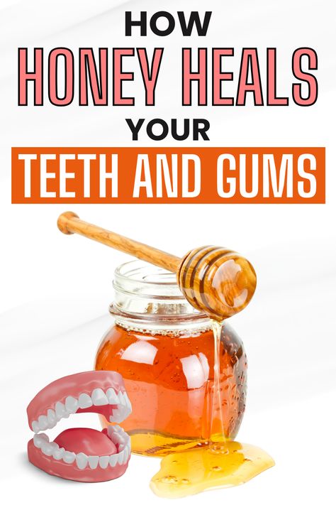 Did you know honey can heal your teeth and gums? This article explores the surprising benefits of honey for oral health, including its natural antibacterial properties and how it can help prevent cavities and soothe gum inflammation. A must-read for a sweeter smile! Heal Cavity Naturally, Healing Teeth Naturally Cavities, Gum Health Remedies, Remineralize Teeth Heal Cavities, Gum Sores, Health Benefits Of Honey, Honey Health Benefits, Remineralize Teeth, Benefits Of Honey