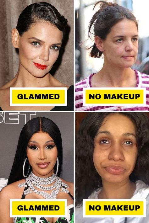 Plastic Surgery Gone Wrong, Celebs Without Makeup, Celebrity Plastic Surgery, Power Of Makeup, Clear Complexion, Bare Face, Celebrity List, Cosmetic Procedures, Without Makeup