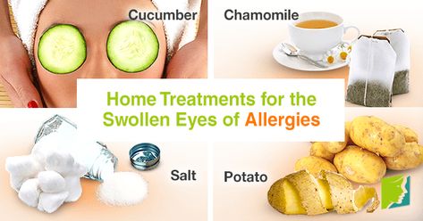 Home Treatments for the Swollen Eyes of Allergies1 Swollen Eyes From Allergies, Swollen Eye Remedies, Swollen Sinuses, Allergies Remedies, Clear Your Sinuses, Allergy Eyes, Home Remedies For Bronchitis, Swollen Eyes, Cramps Relief