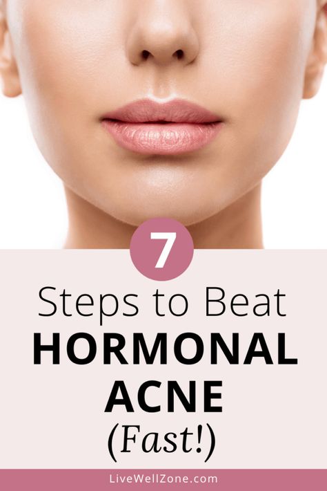 Healthy Skin Care Acne, Get Rid Of Hormonal Acne, Hormonal Acne Diet, Acne Supplements, Hormonal Acne Remedies, Back Acne Remedies, Acne Diet, Acne Skincare Routine, Natural Acne