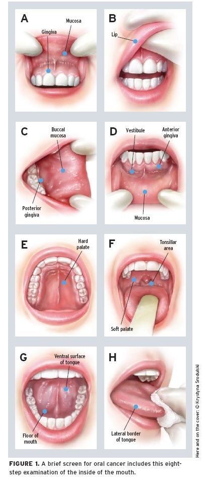 Dental Assistant School, Dental Hygienist School, Dental Assistant Study, Dental Hygiene Student, Dental World, Kedokteran Gigi, Dental Hygiene School, Dentistry Student, Dental Anatomy