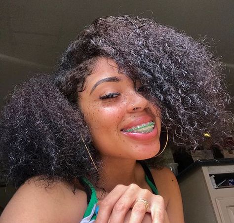 𝘱𝘪𝘯𝘵𝘦𝘳𝘦𝘴𝘵: 𝘴𝘢𝘥𝘵𝘦𝘳𝘮𝘴. ♡ Green Braces, Braces Retainer, Braces Colors Ideas, Natural Teeth Whitening Diy, Cute Braces Colors, Braces Cost, Braces Tips, Getting Braces