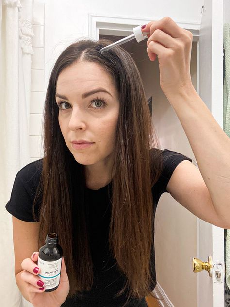 The Ordinary hair serum saved my scalp and improved growth The Ordinary Peptide Hair Serum, The Ordinary Scalp Serum, The Ordinary Hair Serum Before And After, Scalp Serum Hair Growth, Best Hair Serum For Hair Growth, The Ordinary Hair Serum, Ordinary Hair Serum, Hair Serum For Growth, Best Hair Growth Serum