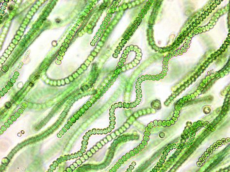 Cyanobacteria | Silviapvadi's Blog Microscopic Photography, Micro Photography, Bio Art, Single Tree, Life On Mars, Prehistoric Creatures, Photosynthesis, Microbiology, Botany