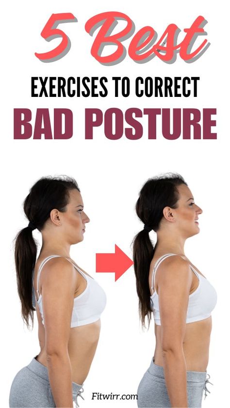 This pin features the pin title "5 daily exercises to correct bad posture", and images of a woman who has an improved better and straighter back posture and the before image where her back posture is poor. Body Posture Exercises, Fix Back Posture, Straight Back Posture, Bad Neck Posture, Bad Posture Exercises, Forward Head Posture Correction, Correct Bad Posture, Stretches For Your Back, Fix Posture