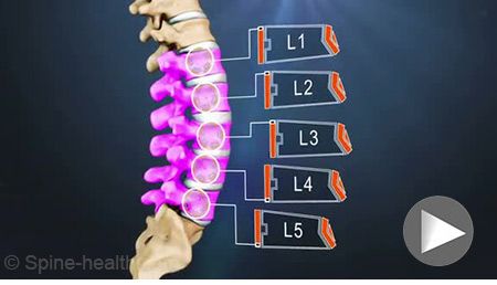 11 Ways to Indulge Your Spine. Lumbar Spine Anatomy Vertebrae L1 through L5 @ spine-health (Trusted Information for Back Pain Relief.. Anatomy Vertebrae, Lower Back Anatomy, Spine Anatomy, Disc Herniation, Spinal Health, Severe Back Pain, Spinal Fusion, Middle Back Pain, Back Health