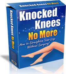 Sarah Brown's Knocked Knees No More PDF eBook download. Feel free to read now! Knocked Knees, Bow Legged Correction, Knock Knees, Sarah Brown, Bow Legged, Perfect Legs, Great Books To Read, Romantic Books, Latest Books