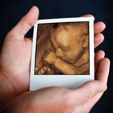 Ultra Sound, 3d Ultrasound, 4d Ultrasound, Baby Art, Prenatal, Ultrasound, Philadelphia Pa, Mothers Love, Philadelphia