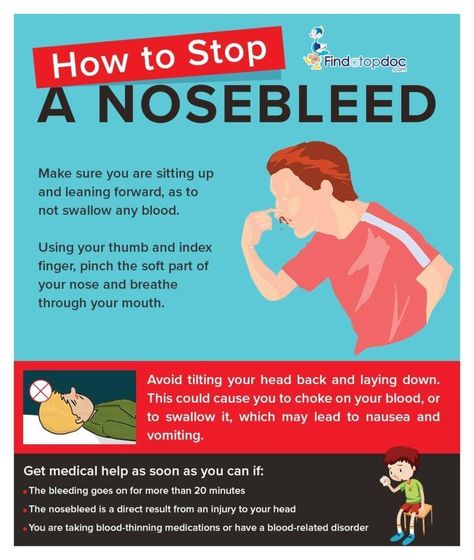 How to Stop a Nose Bleed? [Infographic] Stop Nose Bleeds, Sinus Headache Remedies, Throbbing Headache, First Aid Tips, Nose Cleaner, Nose Bleeds, Sinus Headache, Holistic Health Remedies, Holistic Care