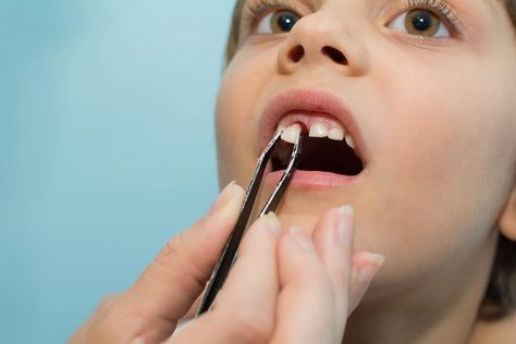 Nobody wants to end up having a mouth with no teeth before the age of 50. Dreaming of your teeth pulling out is not common at all, and it can even get you all worked Teeth Pulling, Rotten Teeth, Losing Teeth, Teeth Covers, Tooth Pulled, No Teeth, Loose Tooth, Good Paying Jobs, February Nails