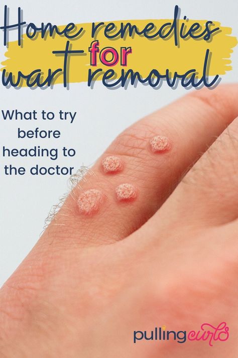 Essential Oils For Warts, Oils For Warts, Different Types Of Warts, Types Of Warts, Warts On Hands, Home Remedies For Warts, Warts Remedy, Get Rid Of Warts, Cold Sores Remedies