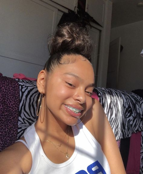 𝒑𝒊𝒏𝒕𝒆𝒓𝒆𝒔𝒕 : @shawtypr ❕ Girls With Braces, Cute Braces Colors, Braces Tips, Getting Braces, Braces Girls, Cute Braces, Brace Face