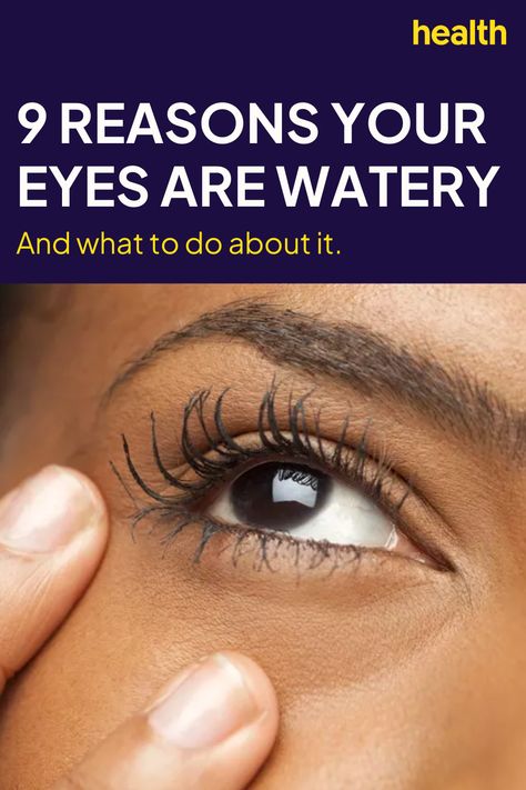 Best Eye Drops For Dry Eyes, Dry Eyes Remedy Natural Treatments, Watery Eyes Remedy, Eye Irritation Remedies, Tearing Eyes, Dry Eye Remedies, Eye Nerves, Blocked Tear Duct, Best Eye Drops