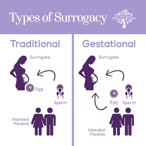 1. Traditional Surrogacy In traditional surrogacy, the surrogate is also the biological mother 👩‍🍼 of the child 👶. Her egg 🥚 is fertilized by the Intended Father's sperm 🧬 or donor sperm through artificial insemination 🧪. This method is less common today due to legal ⚖️ and emotional 🫂 complexities. 2. Gestational Surrogacy Gestational surrogacy involves the surrogate carrying a child 👩‍🍼 that is not biologically related to her. An embryo 🧫, created through IVF 🧬 using the Intended Parents... Gestational Surrogacy, Artificial Insemination, Surrogate Mother, A Child, Egg, Parenting, Quick Saves