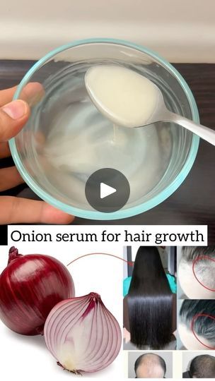 Hair Growth Ingredients, Onion Oil For Hair, Onion Juice For Hair, Onion For Hair, Extreme Hair Growth, Health Care Professionals, Onion Juice, Improve Hair Growth, Beauty Diet