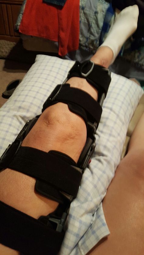 Knee Brace Aesthetic, Injury Aethstetic, Knee Injury Snapchat, Knee Brace Outfit, Injury Aesthetic, Knee Injury Recovery, Broken Knee, Knee Surgery Recovery, Hip Brace