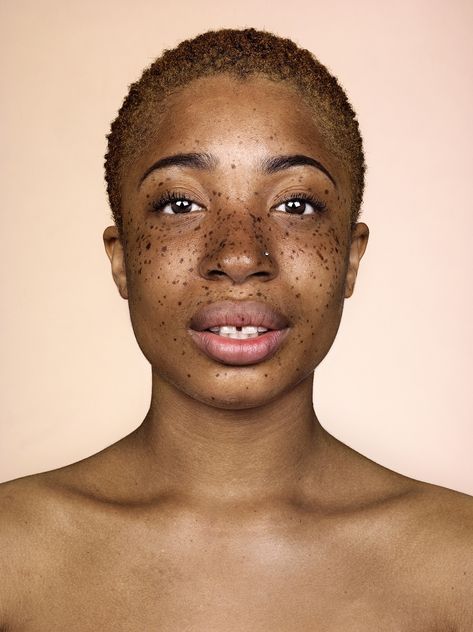 The photographer behind Somerset House’s Beard exhibition returns with another set of bold portraits – and this time, freckles take centre stage The Blacker The Berry, People With Freckles, Freckle Face, Photo Projects, Interesting Faces, Portrait Inspiration, Black Is Beautiful, Drawing People, Face And Body