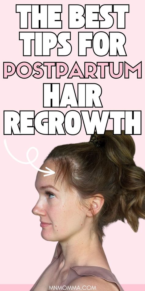 Image of postpartum woman losing her hair after giving birth with text regarding how to stop postpartum hair loss and how to regrow it back Baby Hair Growth, The Best Hair Products, Postpartum Hair, Natural Hair Growth Remedies, Stop Hair Breakage, Best Hair Products, Hair Shedding, Hair Control, Lost Hair