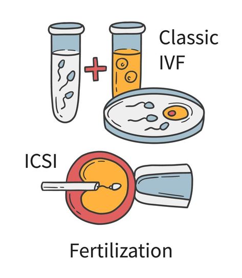 In Vitro fertilization IVF and Intracytoplasmic sperm injection ICSI In Vitro Fertilization, In Vitro, Petri Dish, Styled Stock, Photos Ideas, Fertility, Vector Illustration, How To Draw Hands, Doodles