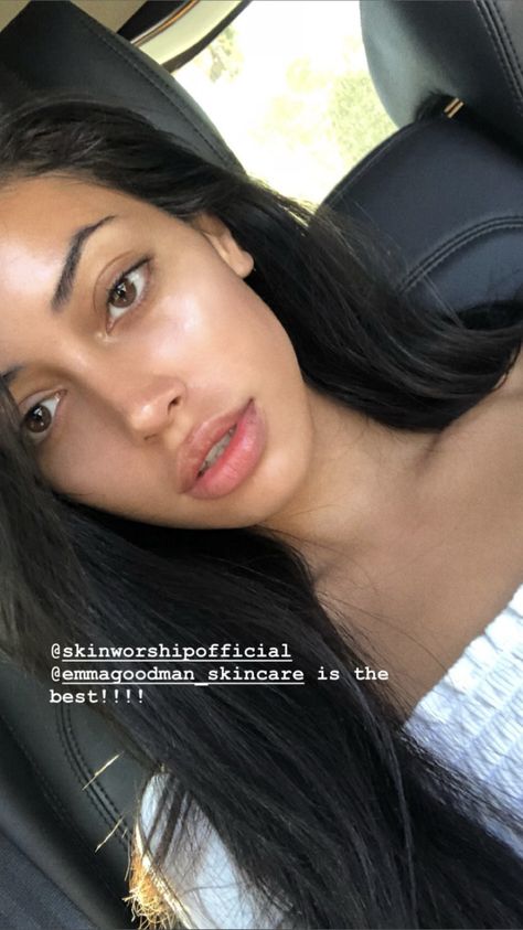 Cindy Kimberly Lips, Perfect Nose Rhinoplasty, Nose Job Front View, Perfect Nose Front View, Nose Surgery Rhinoplasty, Rhinoplasty Nose Jobs, Face Surgery, Job Inspiration, Pretty Nose